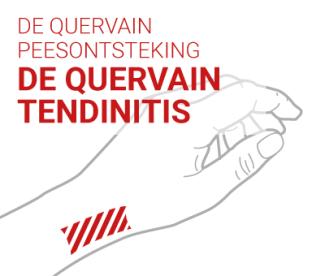 DE QUERVAIN PEESONTSTEKING, DE QUERVAIN TENDINITIS