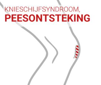 KNIESCHIJFSYNDROOM / PEESONTSTEKING