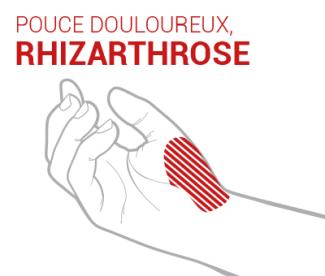 rhizarthrose-pouce-orthèses-epitact