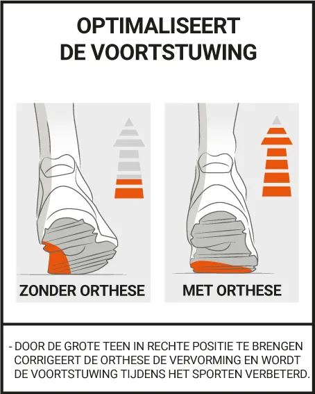 CORRIGERENDE HALLUX VALGUS ORTHESE SPORT