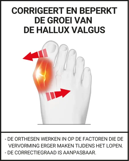 CORRIGEERT EN BEPERKT DE GROEI VAN DE HALLUX VALGUS