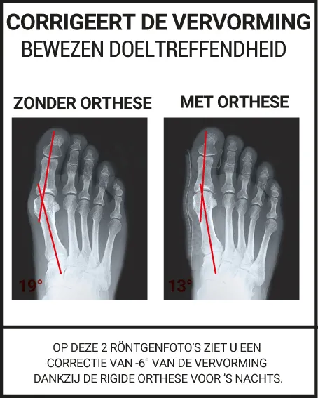 CORRIGEERT DE VERVORMING BEWEZEN DOELTREFFENDHEID