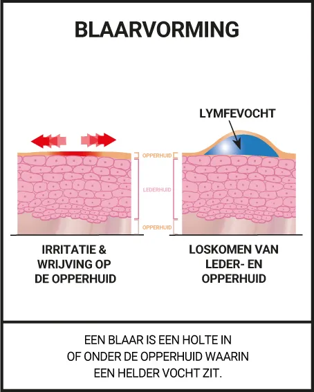 ZE BLIJVEN PERFECT ZITTEN, ZELFS IN EXTREME OMSTANDIGHEDEN (KOUDE, WARMTE, VOCHT,...)!
