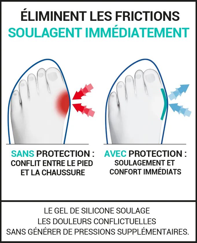 PROTECTIONS HALLUX VALGUS