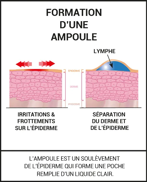 Protègent des frottements, préviennent les ampoules et soulagent la douleur.