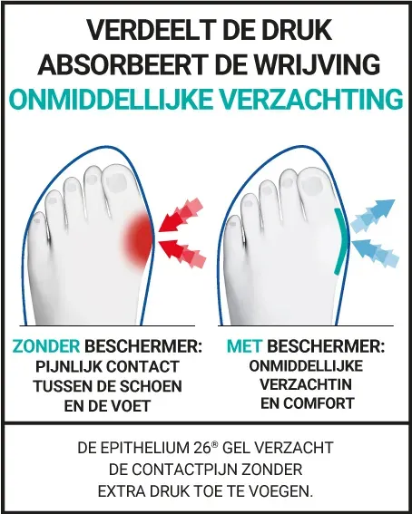 HALLUX VALGUS BESCHERMER